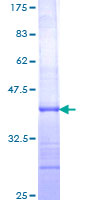 IL12B / IL12 p40 Protein - 12.5% SDS-PAGE Stained with Coomassie Blue.