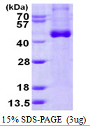 IL12B / IL12 p40 Protein
