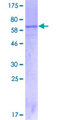 IL12RB1 / CD212 Protein - 12.5% SDS-PAGE of human IL12RB1 stained with Coomassie Blue