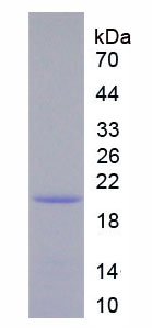 IL12RB1 / CD212 Protein - Recombinant Interleukin 12 Receptor Beta 1 By SDS-PAGE
