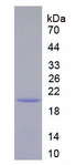 IL12RB1 / CD212 Protein - Recombinant Interleukin 12 Receptor Beta 1 By SDS-PAGE