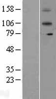 IL12RB2 Protein - Western validation with an anti-DDK antibody * L: Control HEK293 lysate R: Over-expression lysate