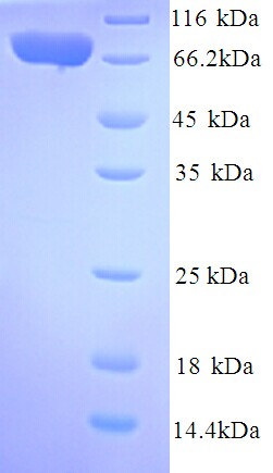 IL12RB2 Protein