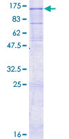 IL12RB2 Protein - 12.5% SDS-PAGE of human IL12RB2 stained with Coomassie Blue