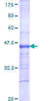 IL12RB2 Protein - 12.5% SDS-PAGE Stained with Coomassie Blue.