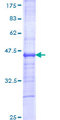 IL12RB2 Protein - 12.5% SDS-PAGE Stained with Coomassie Blue.