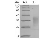 IL13 Protein - Recombinant Human Interleukin-13/IL-13 (C-Avi-6His) Biotinylated