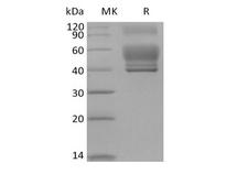 IL13 Protein - Recombinant Human Interleukin-13/IL-13 (C-Fc)
