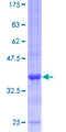IL13 Protein - 12.5% SDS-PAGE of human IL13 stained with Coomassie Blue