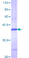 IL13 Protein - 12.5% SDS-PAGE Stained with Coomassie Blue.