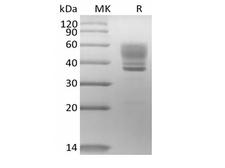 IL13 Protein - Recombinant Human Interleukin-13/IL-13 (C-mFc)