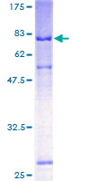 IL13RA1 / IL13R Alpha 1 Protein - 12.5% SDS-PAGE of human IL13RA1 stained with Coomassie Blue