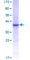 IL13RA2 / IL13R Alpha 2 Protein - 12.5% SDS-PAGE Stained with Coomassie Blue.