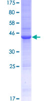 IL15 Protein - 12.5% SDS-PAGE of human IL15 stained with Coomassie Blue