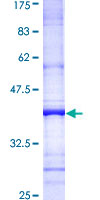 IL15 Protein - 12.5% SDS-PAGE Stained with Coomassie Blue.