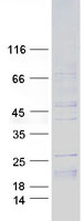 IL15 Protein - Purified recombinant protein IL15 was analyzed by SDS-PAGE gel and Coomassie Blue Staining
