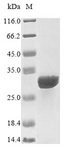 IL15RA Protein - (Tris-Glycine gel) Discontinuous SDS-PAGE (reduced) with 5% enrichment gel and 15% separation gel.