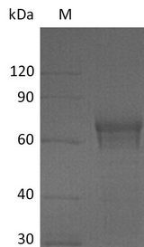 IL15RA Protein - (Tris-Glycine gel) Discontinuous SDS-PAGE (reduced) with 5% enrichment gel and 15% separation gel.