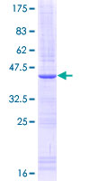 IL15RA Protein - 12.5% SDS-PAGE Stained with Coomassie Blue.