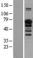 IL16 Protein - Western validation with an anti-DDK antibody * L: Control HEK293 lysate R: Over-expression lysate