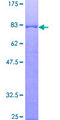 IL16 Protein - 12.5% SDS-PAGE of human IL16 stained with Coomassie Blue