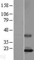 IL17A Protein - Western validation with an anti-DDK antibody * L: Control HEK293 lysate R: Over-expression lysate