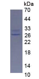 IL17A Protein - Eukaryotic Interleukin 17 By SDS-PAGE