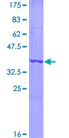 IL17A Protein - 12.5% SDS-PAGE Stained with Coomassie Blue.