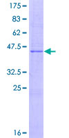 IL17B Protein - 12.5% SDS-PAGE of human IL17B stained with Coomassie Blue