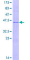 IL17B Protein - 12.5% SDS-PAGE of human IL17B stained with Coomassie Blue