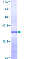 IL17B Protein - 12.5% SDS-PAGE Stained with Coomassie Blue.