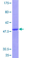 IL17C Protein - 12.5% SDS-PAGE of human IL17C stained with Coomassie Blue