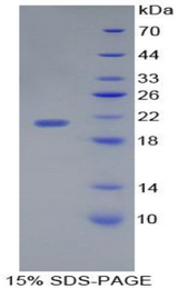 IL17C Protein - Recombinant Interleukin 17C By SDS-PAGE