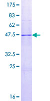 IL17D Protein - 12.5% SDS-PAGE of human IL17D stained with Coomassie Blue