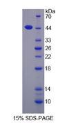 IL17D Protein - Recombinant Interleukin 17D By SDS-PAGE