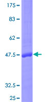 IL17F Protein - 12.5% SDS-PAGE of human IL17F stained with Coomassie Blue