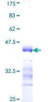 IL17F Protein - 12.5% SDS-PAGE Stained with Coomassie Blue.