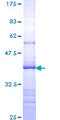 IL17RA Protein - 12.5% SDS-PAGE Stained with Coomassie Blue.