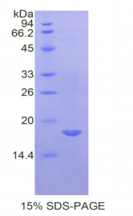 IL17RA Protein - Recombinant Interleukin 17 Receptor A By SDS-PAGE