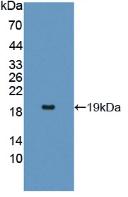 IL17RA Protein - Active Interleukin 17 Receptor A (IL17RA) by WB