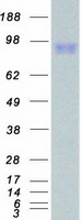 IL17RA Protein - Purified recombinant protein IL17RA was analyzed by SDS-PAGE gel and Coomassie Blue Staining