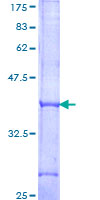 IL17RB Protein - 12.5% SDS-PAGE Stained with Coomassie Blue.