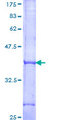 IL17RB Protein - 12.5% SDS-PAGE Stained with Coomassie Blue.