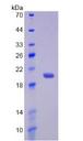 IL17RB Protein - Active Interleukin 17 Receptor B (IL17RB) by SDS-PAGE