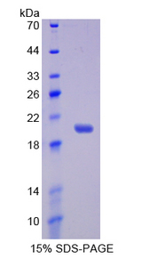 IL17RB Protein - Recombinant  Interleukin 17 Receptor B By SDS-PAGE