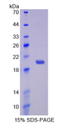 IL17RB Protein - Recombinant  Interleukin 17 Receptor B By SDS-PAGE