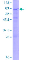 IL17RC Protein - 12.5% SDS-PAGE of human IL17RC stained with Coomassie Blue