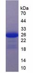 IL17RC Protein - Active Interleukin 17 Receptor C (IL17RC) by SDS-PAGE