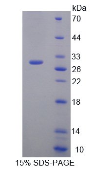 IL17RC Protein - Recombinant  Interleukin 17 Receptor C By SDS-PAGE