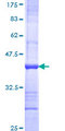 IL17RD Protein - 12.5% SDS-PAGE Stained with Coomassie Blue.